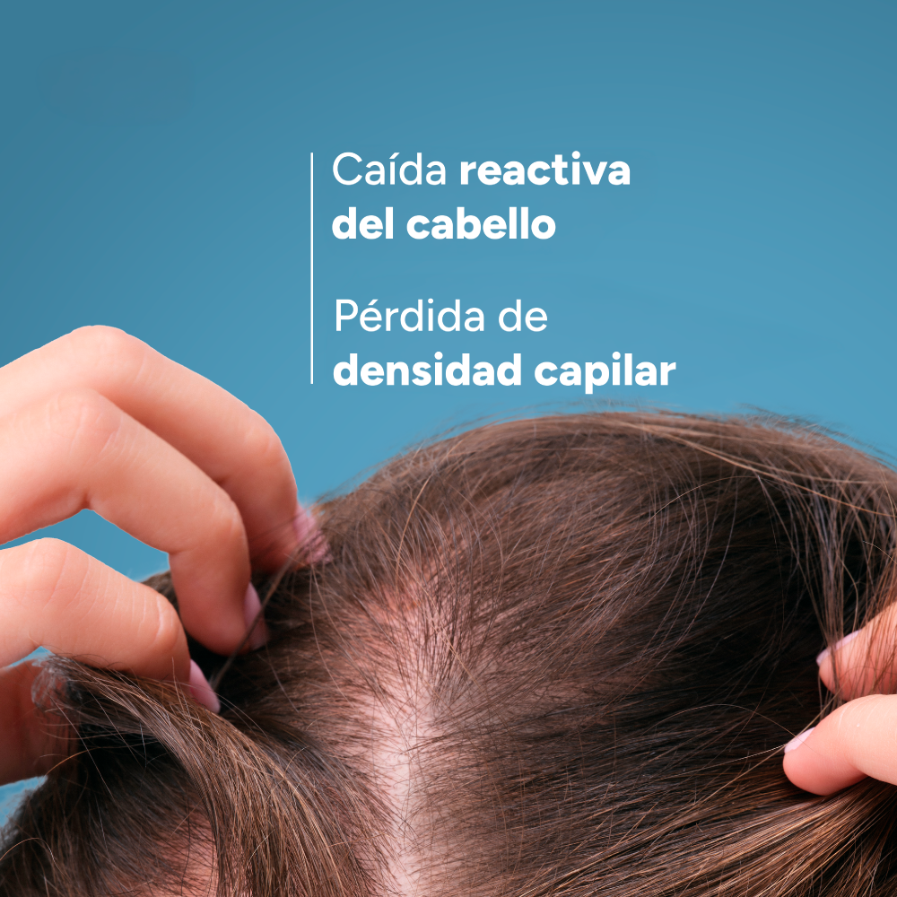 Anaphase+ Acondicionador 200 ML