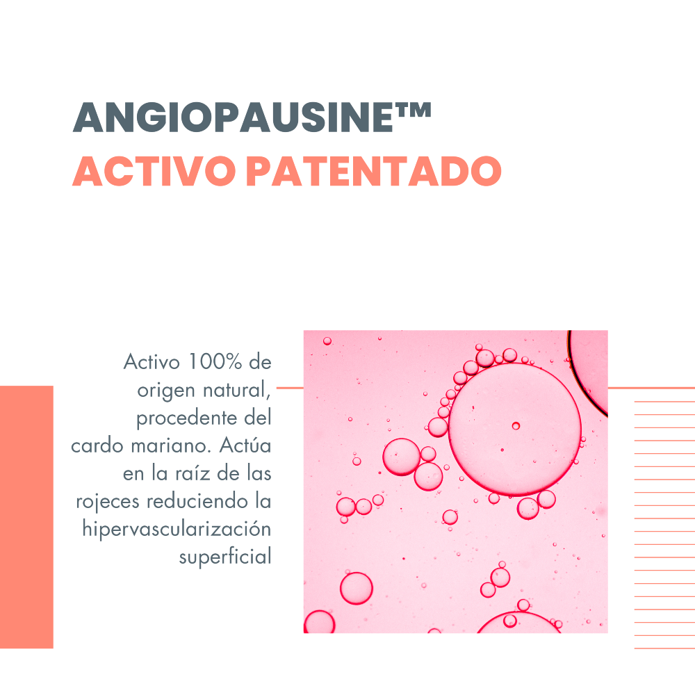 Antirrojeces Rosamed Concentrado 30 ML